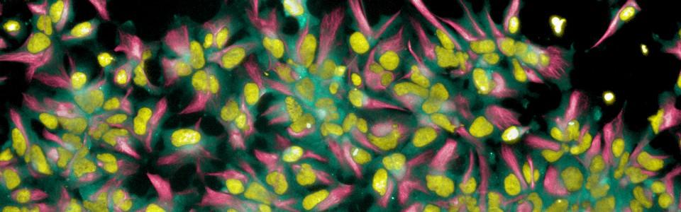 imagem de Estudo revela novos alvos terapêuticos contra o Zika