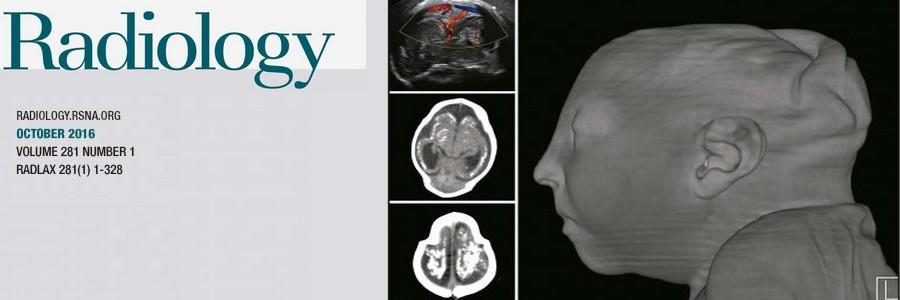 imagem de IDOR é destaque no podcast da AJNR