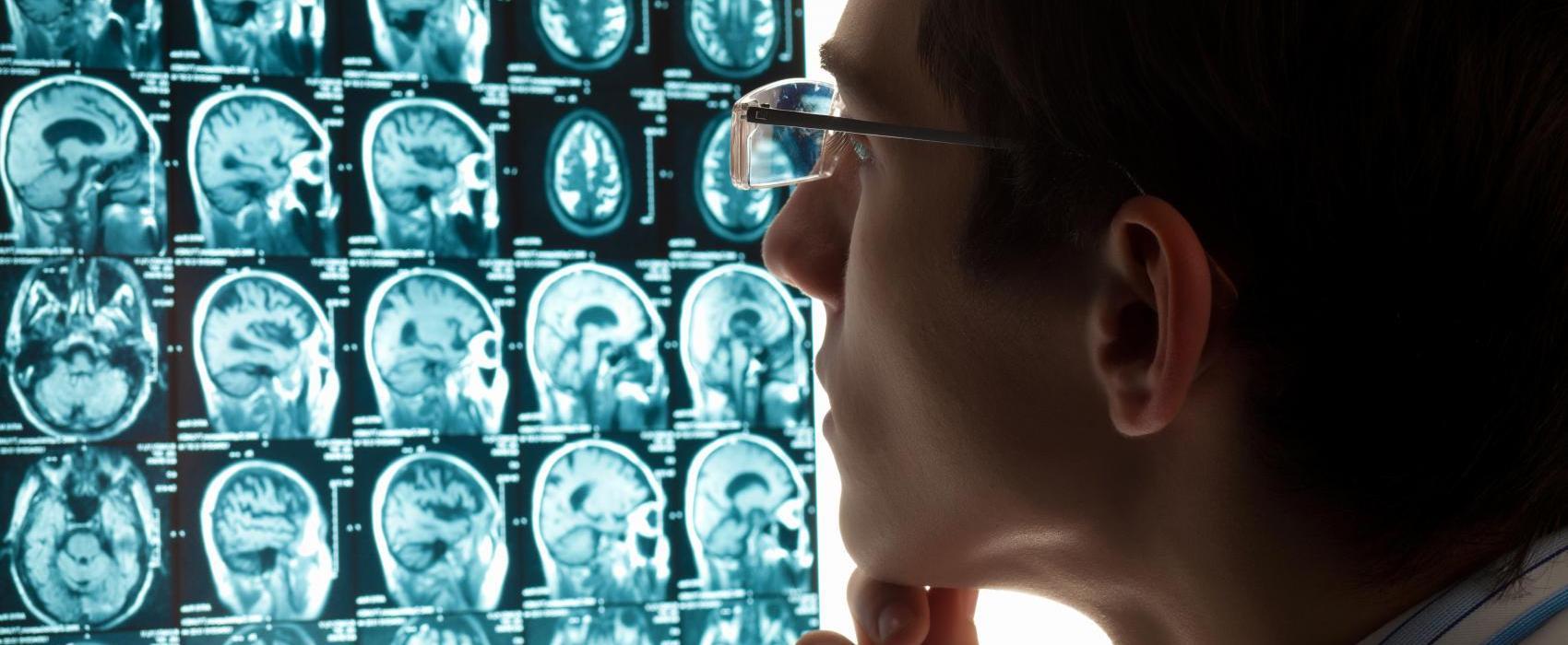 imagem de Conheça a Memory Clinic