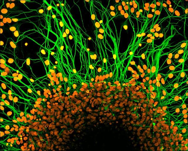 imagem de Dr. Rodrigo Madeiro, Pós-Doc do Instituto D'OR, é finalista em competição da Nikon