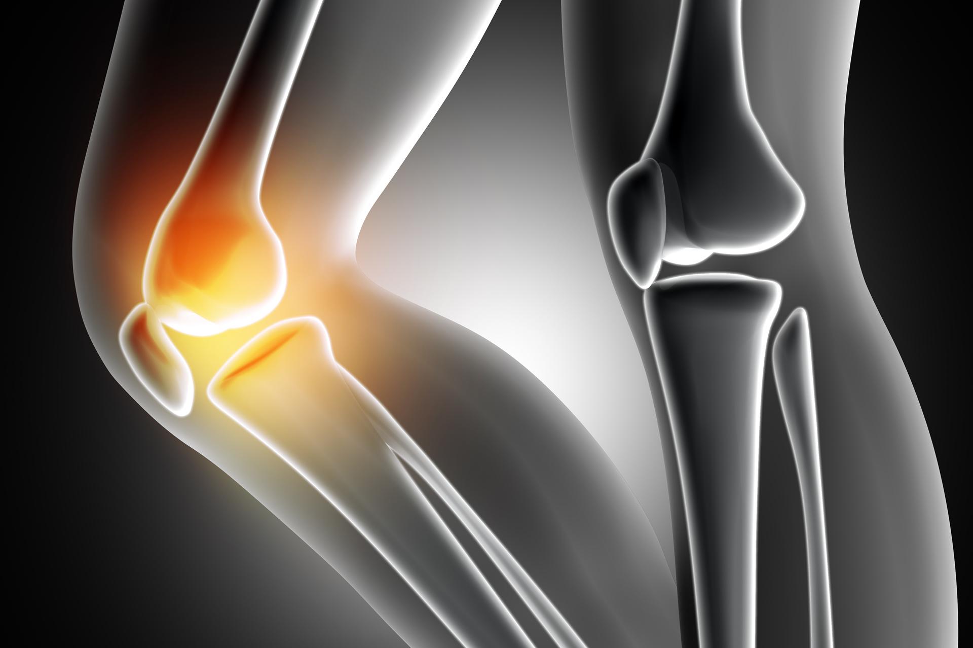 imagem de Inscrições abertas para a pós-graduação em Cirurgia do Joelho R4!