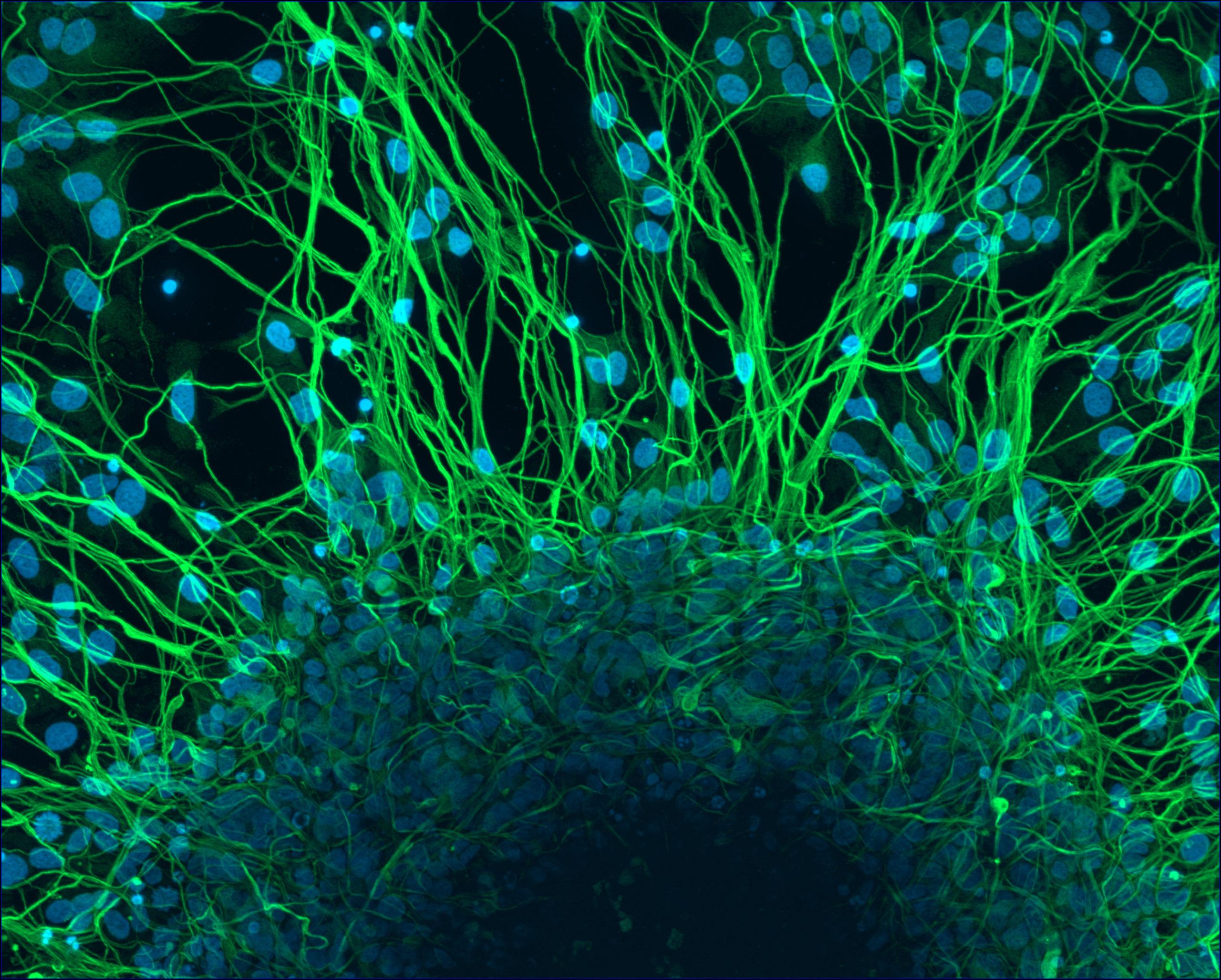 imagem de Cientistas criam neurônios humanos que respondem a estímulos dolorosos