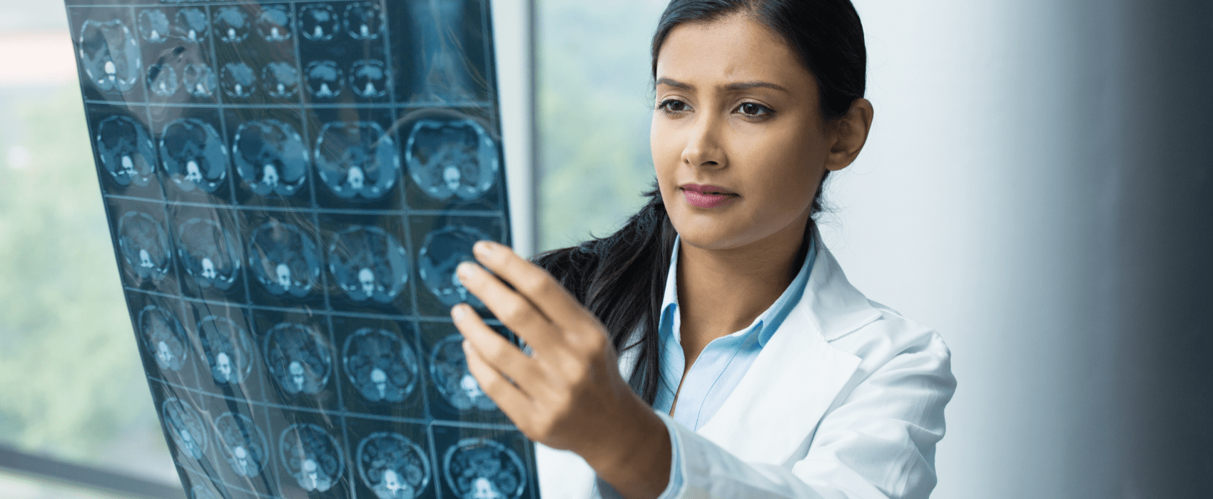 imagem de Inteligência artificial e o futuro da radiologia