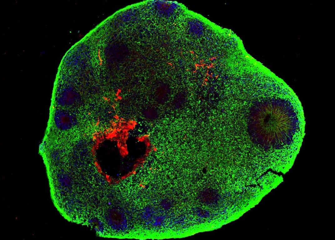 imagem de Cada vez mais complexos