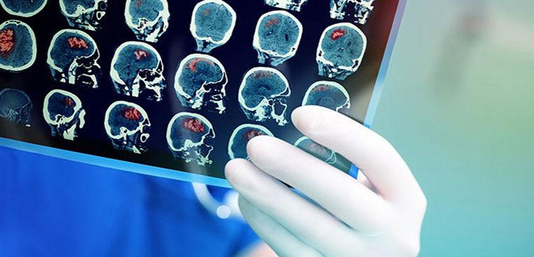 imagem de Palestra sobre Infecções Congênitas do SNC com Dra. Deborah Levine