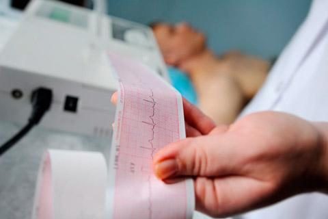 imagem de Fibrilação atrial, conheça uma das principais causas do AVC