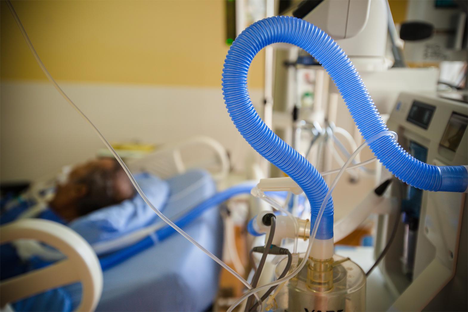 imagem de Impacto e taxa de mortalidade da Covid-19 se manifesta desigualmente na população