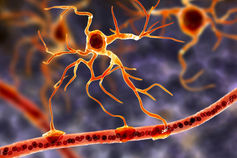 Novo estudo sugere respostas neuroinflamatórias em pacientes com esquizofrenia
