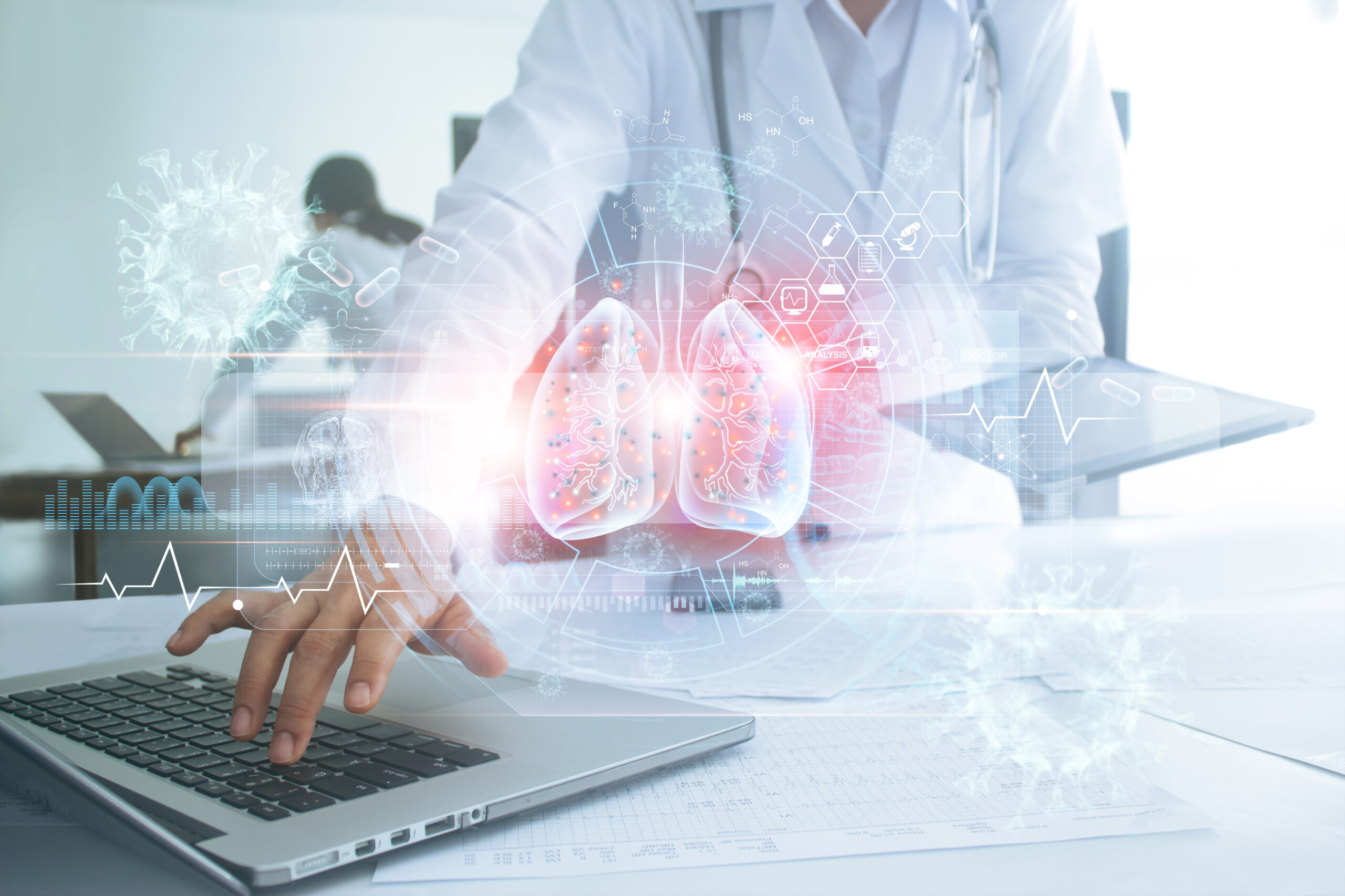 IDOR participa da criação de IA que identifica câncer de pulmão incidental em laudos médicos