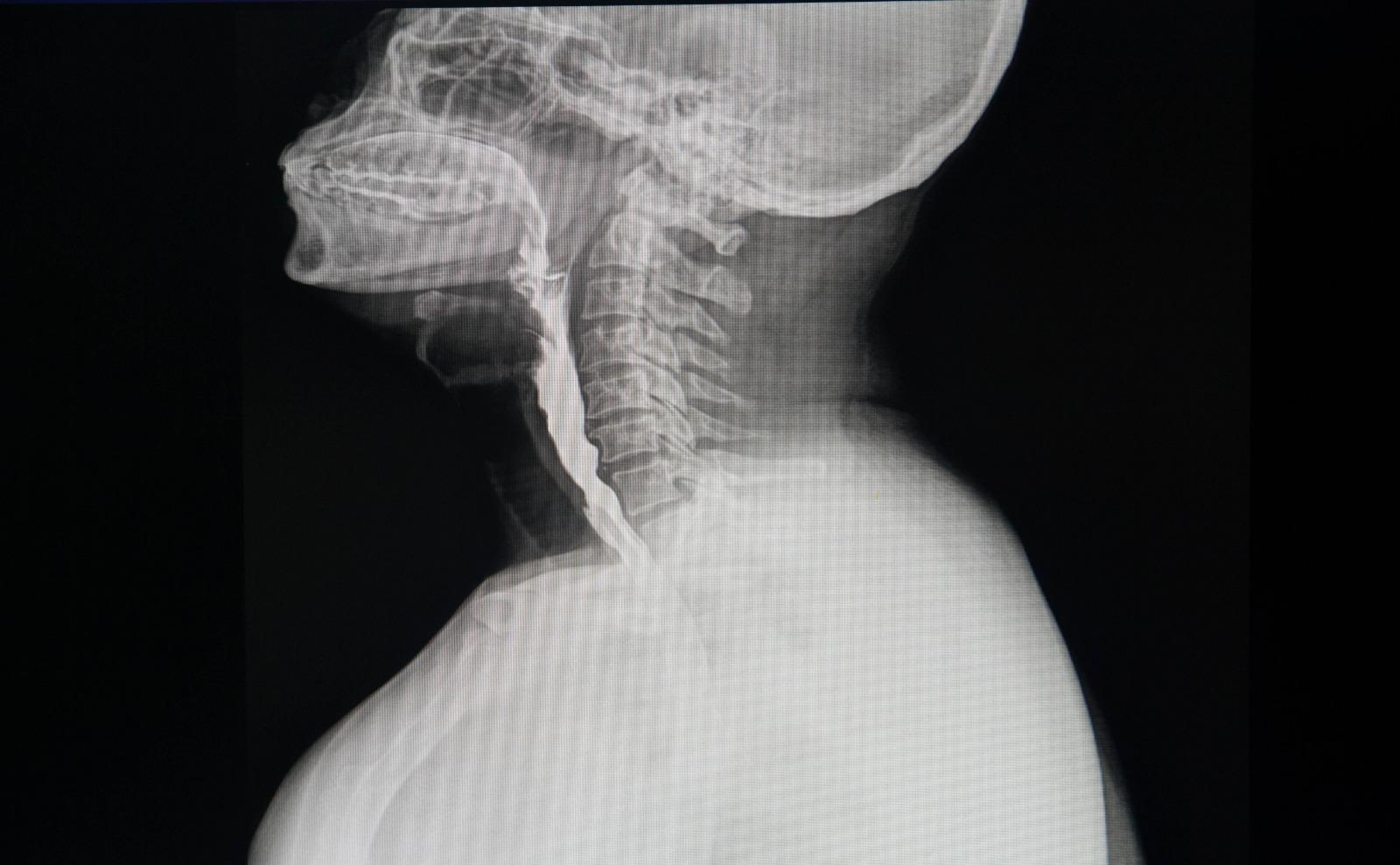 imagem de Pós-Graduação em Fonoaudiologia Hospitalar do IDOR