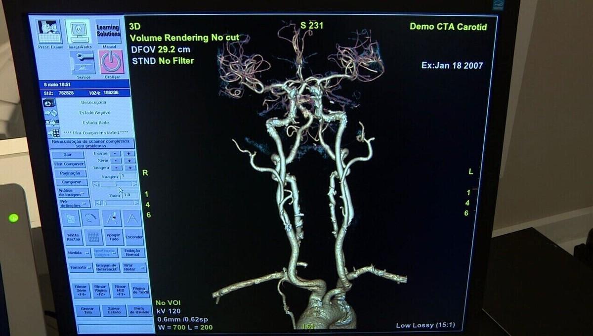 imagem de Cirurgia robótica, pesquisa e R$ 70,1 milhões em equipamentos: g1 visita hospital construído na antiga rodoviária de Campinas