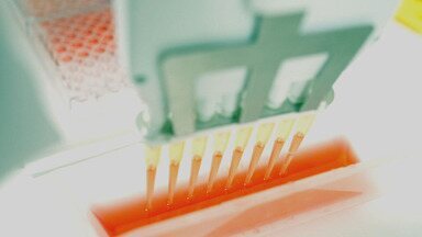 imagem de Globo | O hormônio do exercício que está sendo produzido em laboratório e deverá ajudar pessoas que não podem se exercitar