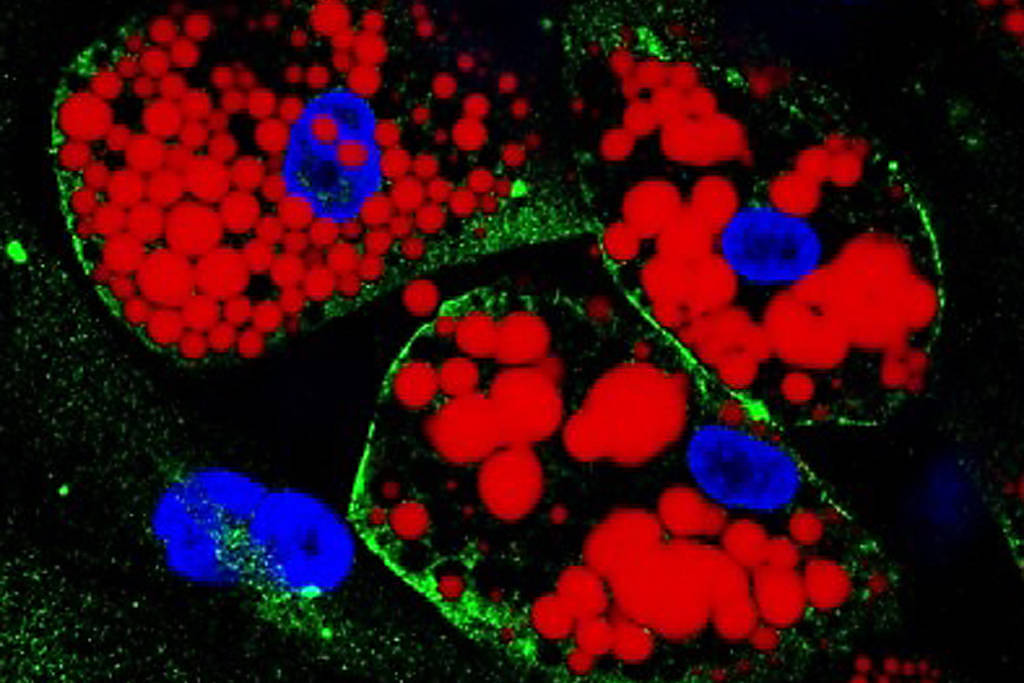 imagem de Folha de São Paulo: Infecção de células da gordura visceral pode contribuir para o agravamento da Covid-19, sugere estudo