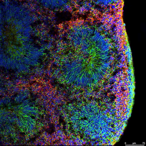 imagem de Inverse: This Scientist Is Re-creating the Human Brain in a Lab to Study Psychedelics
