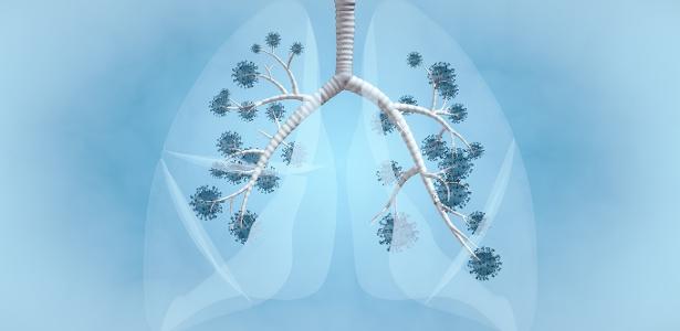 imagem de Lucia Helena - Covid longa: estudo 'enxerga' diferenças que eram invisíveis nos pulmões